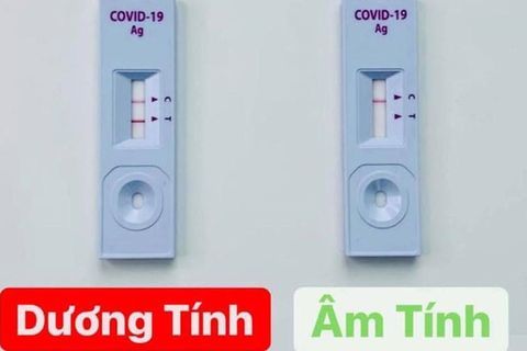 Khi tự test nhanh cho kết quả dương tính, người dân cần xử trí như thế nào?