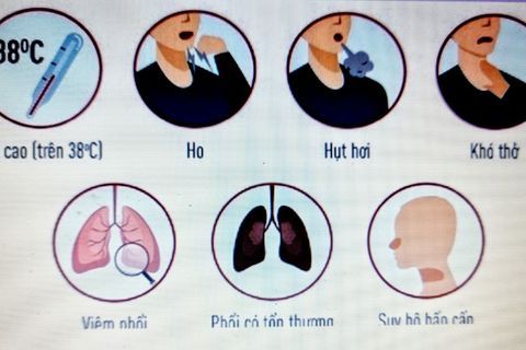 Một số triệu chứng lâm sàng khi nhiễm Covid-19