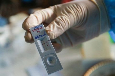 Ai có nguy cơ tái nhiễm COVID-19 cao hơn?