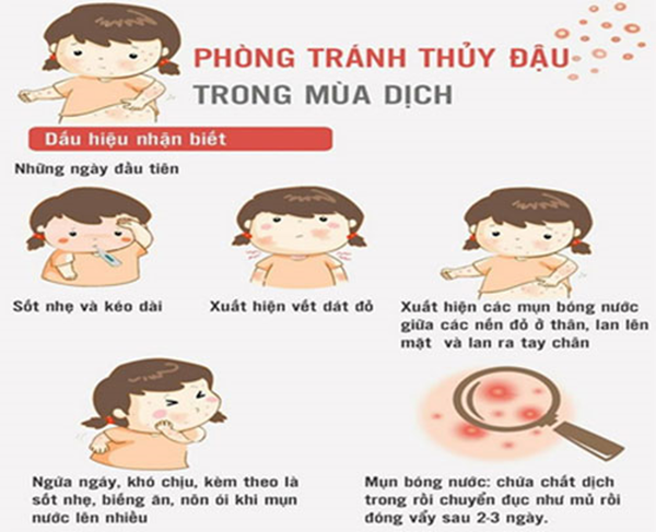 http://mnchuvanantayho.edu.vn/upload/29450/fck/hni-tayho-mnchuvanan/thuy-dau_08042021.png